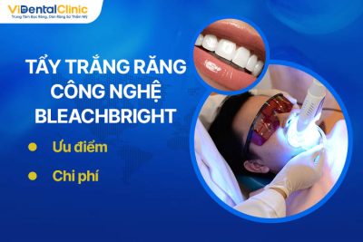 Tẩy Trắng Răng Công Nghệ Bleachbright: Ưu Điểm, Chi Phí