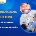 Tẩy Trắng Răng Nha Khoa Nên Không? Có Phương Pháp Nào?