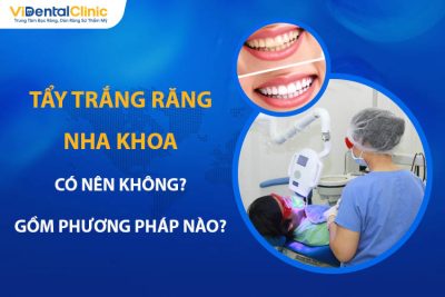 Tẩy Trắng Răng Nha Khoa Nên Không? Có Phương Pháp Nào?