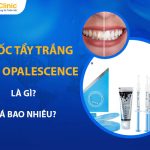 Thuốc Tẩy Trắng Răng Opalescence Là Gì? Giá Bao Nhiêu?