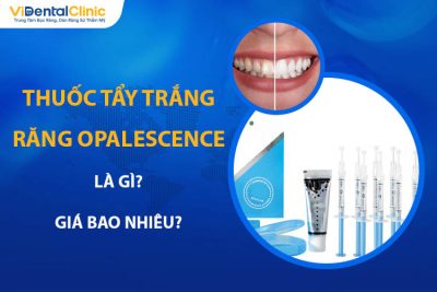 Thuốc Tẩy Trắng Răng Opalescence Là Gì? Giá Bao Nhiêu?