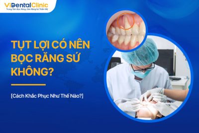 Tụt Lợi Có Nên Bọc Răng Sứ Không? Cách Khắc Phục Như Thế Nào?