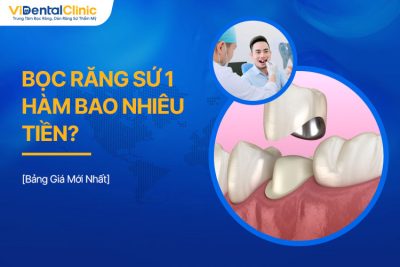 Bọc Răng Sứ 1 Hàm Bao Nhiêu Tiền? Bảng Giá Mới Nhất