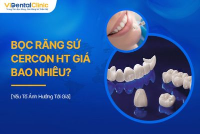 Bọc Răng Sứ Cercon Ht Giá Bao Nhiêu? Yếu Tố Ảnh Hưởng Tới Giá