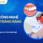 8 Công Nghệ Làm Trắng Răng Hiệu Quả, An Toàn Hiện Nay