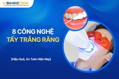 8 Công Nghệ Làm Trắng Răng Hiệu Quả, An Toàn Hiện Nay