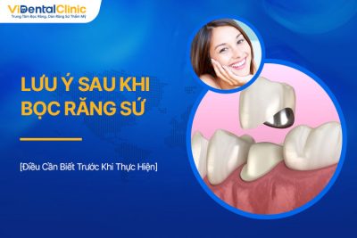 Lưu Ý Sau Khi Bọc Răng Sứ Và Điều Cần Biết Trước Khi Thực Hiện