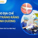 Top 10 Địa Chỉ Tẩy Trắng Răng Bình Dương Chất Lượng