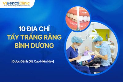 Top 10 Địa Chỉ Tẩy Trắng Răng Bình Dương Chất Lượng