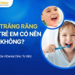 Tẩy Trắng Răng Cho Trẻ Em Có Nên Không? Phải Làm Thế Nào?