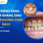 Tẩy Trắng Răng Nhiễm Kháng Sinh Bằng Phương Pháp Nào? 