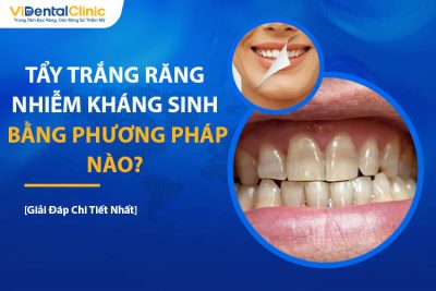 Tẩy Trắng Răng Nhiễm Kháng Sinh Bằng Phương Pháp Nào? 