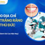 10 Địa Chỉ Tẩy Trắng Răng Thủ Đức Uy Tín Hiện Nay