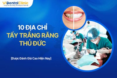 10 Địa Chỉ Tẩy Trắng Răng Thủ Đức Uy Tín Hiện Nay