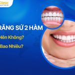 Bọc Răng Sứ 2 Hàm Có Nên Không? Giá Bao Nhiêu?