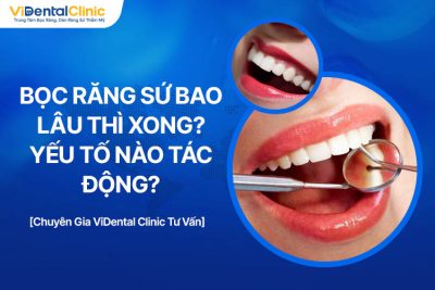 Bọc Răng Sứ Bao Lâu Thì Xong? Yếu Tố Nào Tác Động?