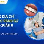 Bọc Răng Sứ Quận 9 Ở Đâu? Top 5 Địa Chỉ Uy Tín Nhất