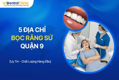 Bọc Răng Sứ Quận 9 Ở Đâu? Top 5 Địa Chỉ Uy Tín Nhất