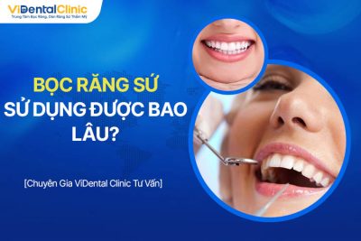 Bọc Răng Sứ Sử Dụng Được Bao Lâu? Chuyên Gia Giải Đáp