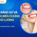 Bọc Răng Sứ Và Những Biến Chứng Khó Lường Bạn Nên Biết