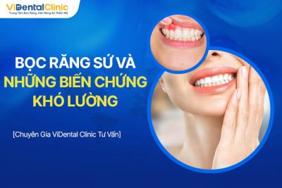 Bọc Răng Sứ Và Những Biến Chứng Khó Lường Bạn Nên Biết