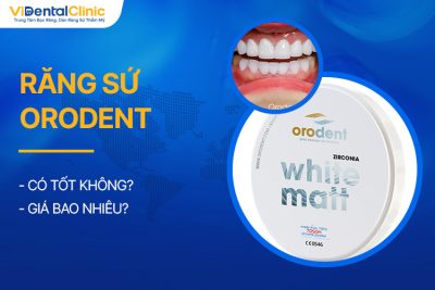 Răng Sứ Orodent Có Tốt Không? Giá Bao Nhiêu?