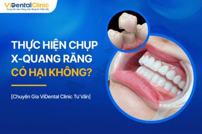 Bọc Răng Sứ Sau Này Có Ảnh Hưởng Gì Không? Giải Đáp