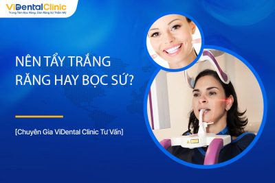 Răng Xỉn Màu Nên Tẩy Trắng Răng Hay Bọc Sứ Là Tốt Nhất?   